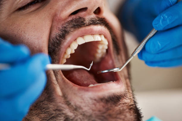 Best Emergency Dental Care for Trauma or Injury in Cokato, MN